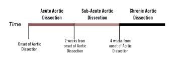 Acute-Aortic-Dissections_classifying